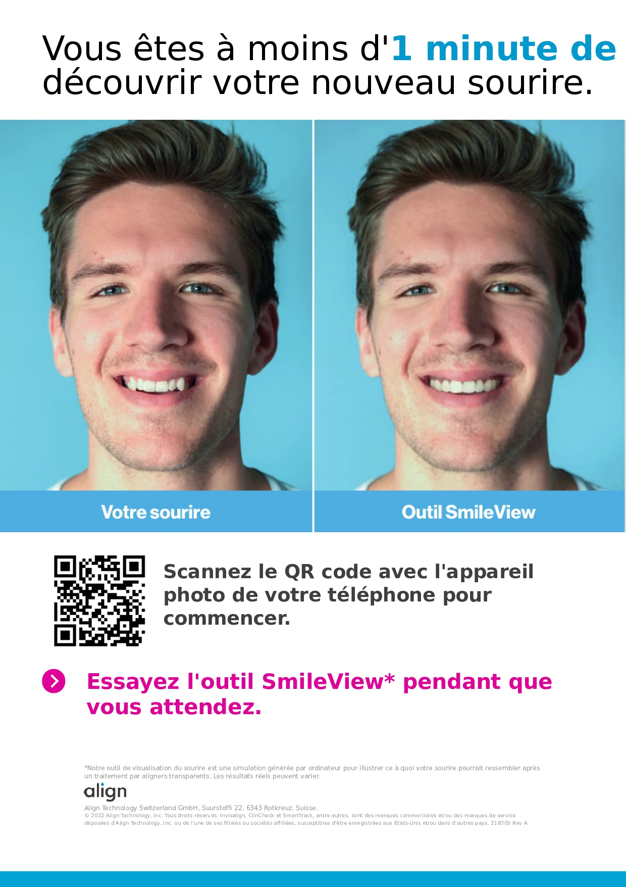 Avant Apres Invisalign casablanca maroc